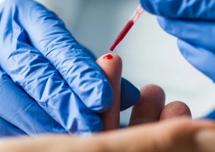 Diagnosis testing